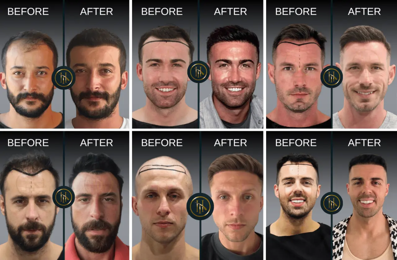 Now Hair Time Before After
