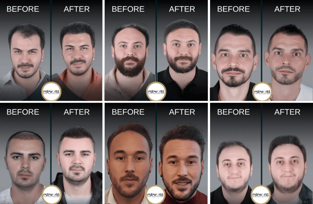 esteworld1
