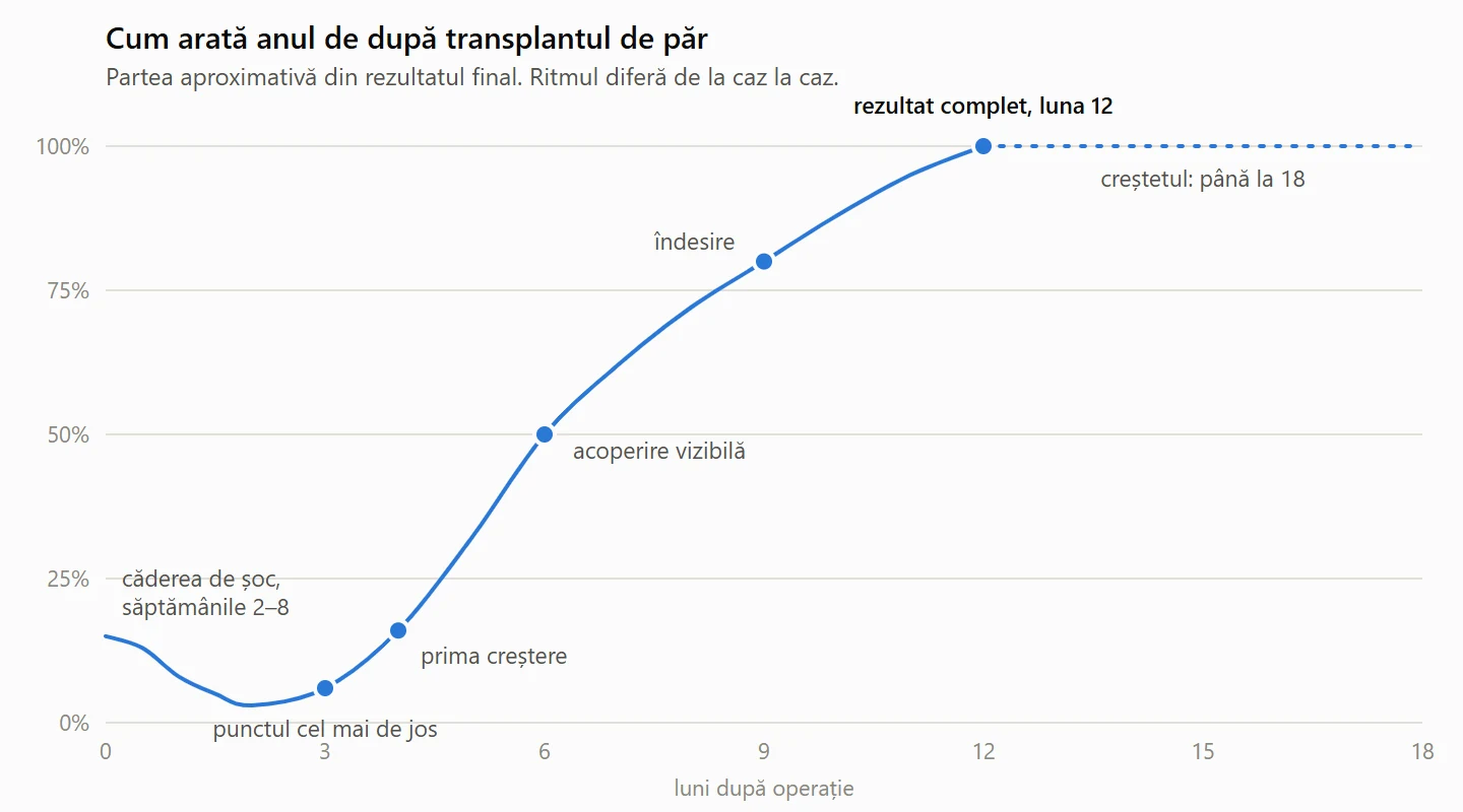 Curba de creștere după transplantul de păr: scădere din cauza căderii de șoc în săptămânile 2–8, punctul cel mai de jos în jurul lunii 3, prima creștere în luna 4, acoperire vizibilă în luna 6 și rezultat complet în luna 12, creștetul continuând până în luna 18.
