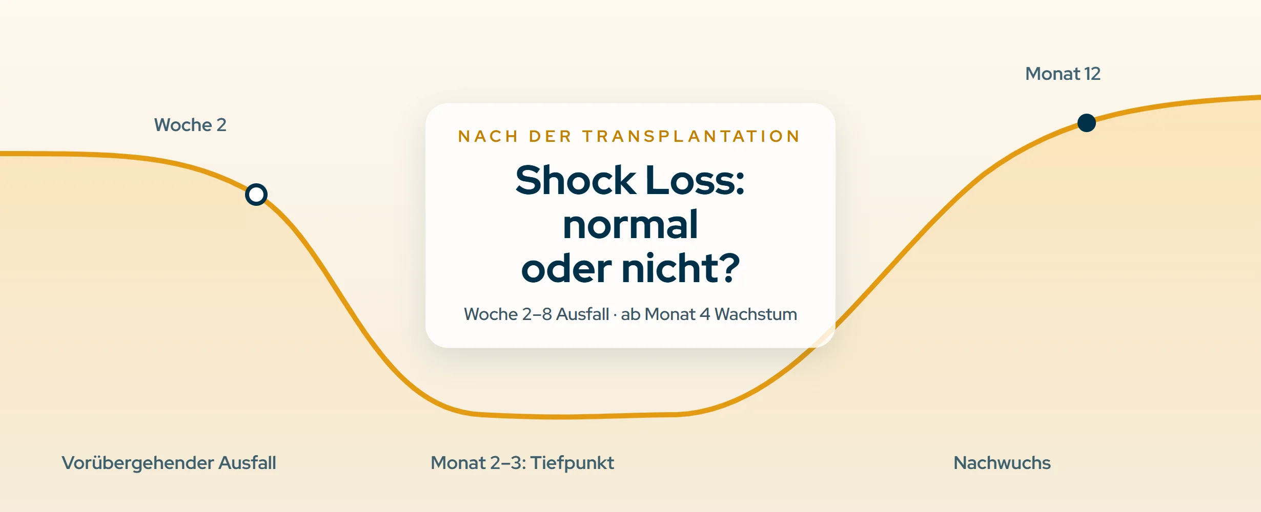 Shock Loss nach Haartransplantation: Was normal ist (2026)
