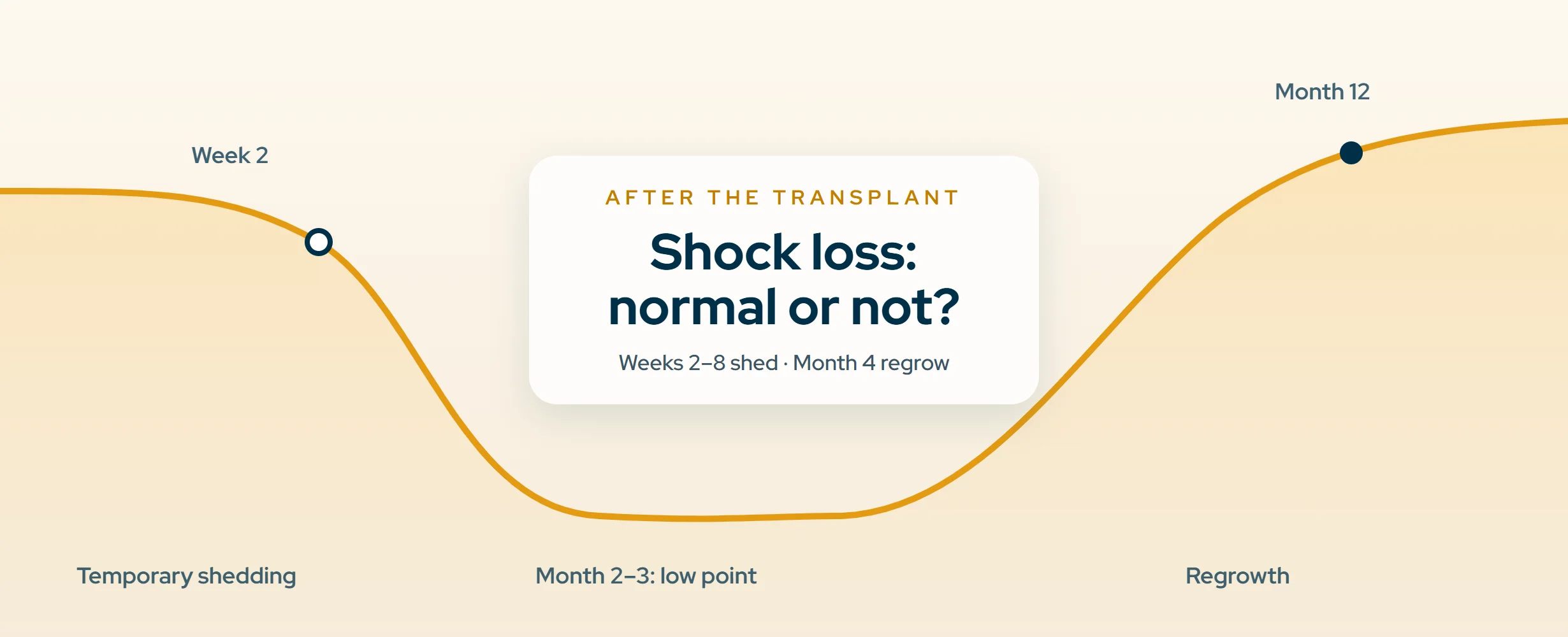 Shock Loss After Hair Transplant: What's Normal (2026)
