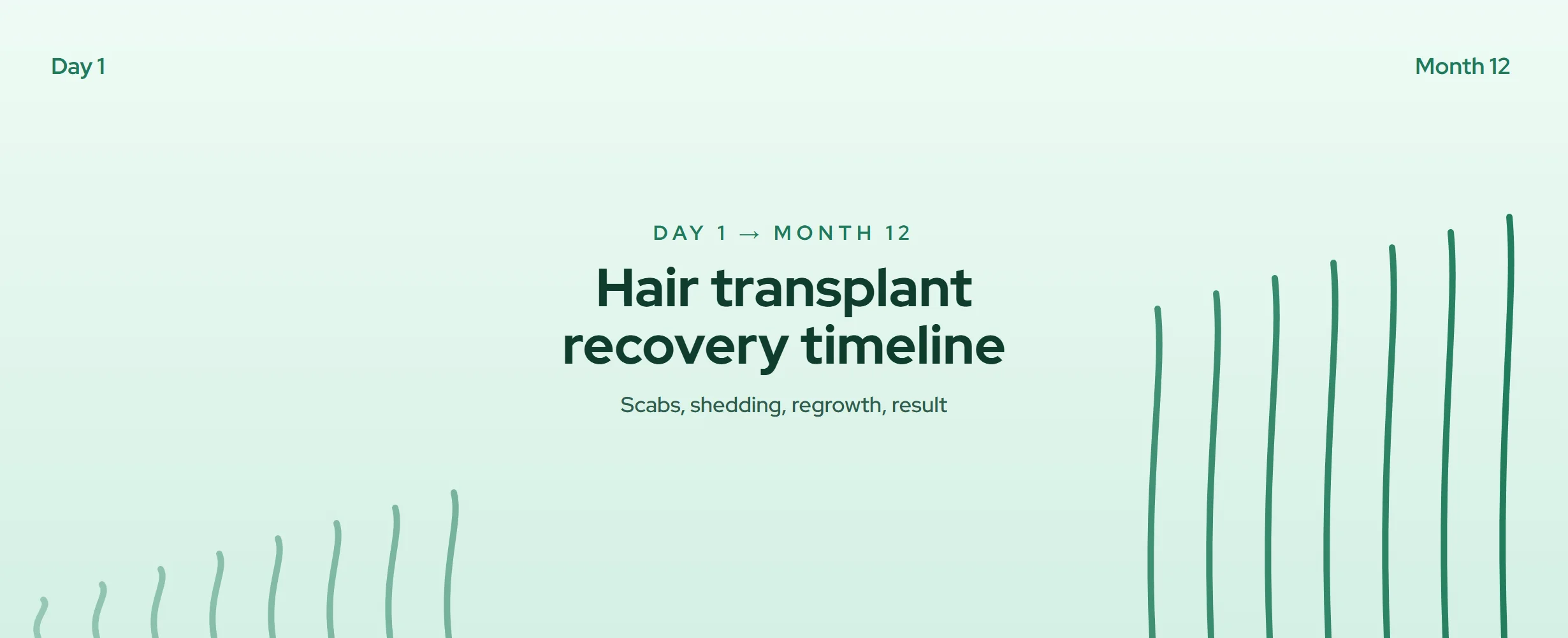 Hair Transplant Recovery Timeline: Day 1 to Month 12 (2026)