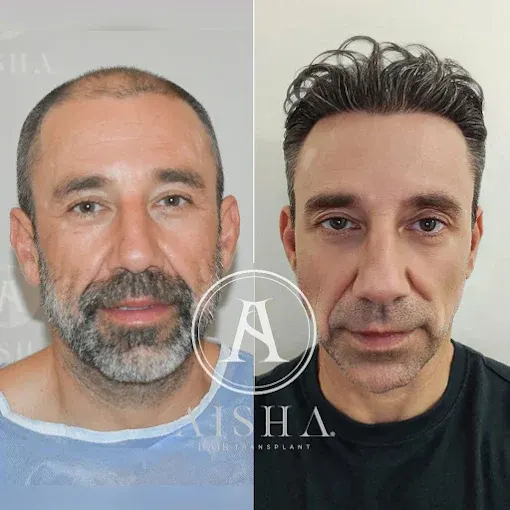 Aisha Hair Clinic