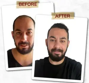 Art Hair Clinic