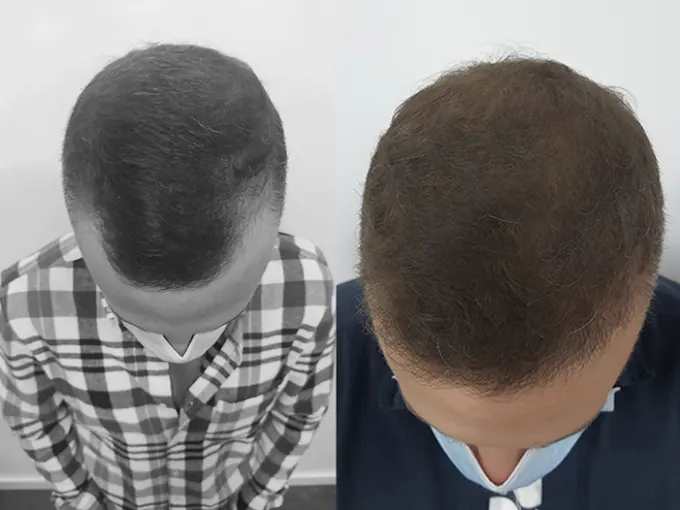 Capilclinic