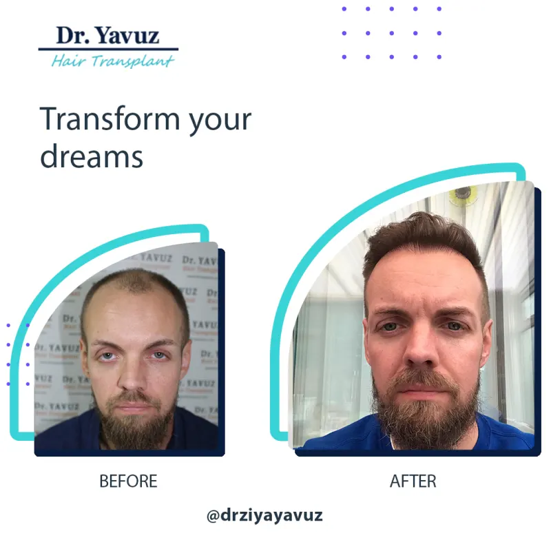 Dr. Ziya Yavuz Clinic