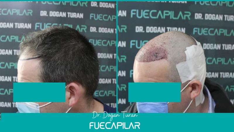 FueCapilar Clinic