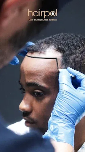 Hairpol Clinic