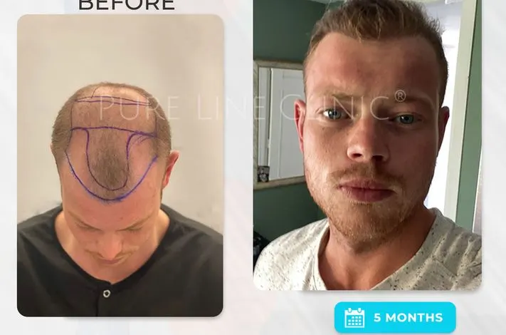 Pure Line Clinic