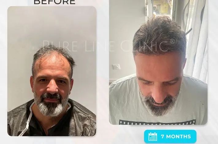 Pure Line Clinic