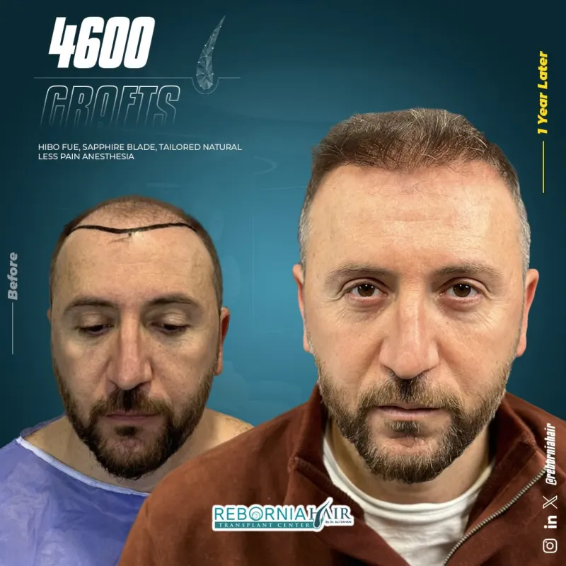 Rebornia Hair Clinic