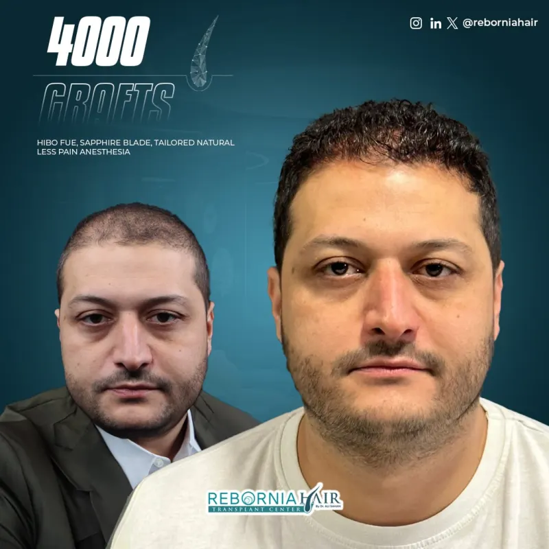 Rebornia Hair Clinic